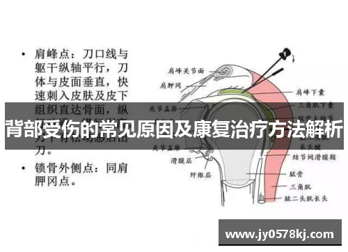 背部受伤的常见原因及康复治疗方法解析